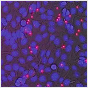 Fluorescence image reveals KYSE cells